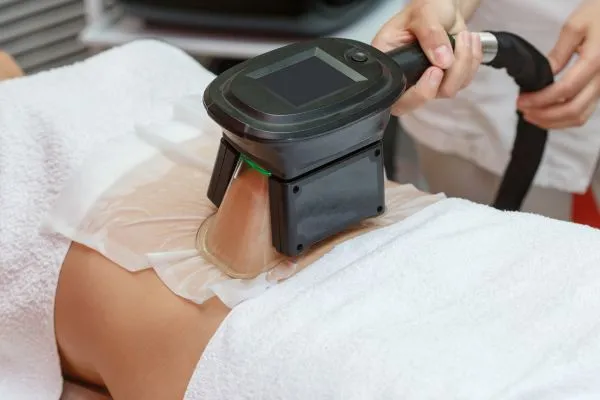 Image of person having fat freezing treatment to help weight gain Blandford Forum