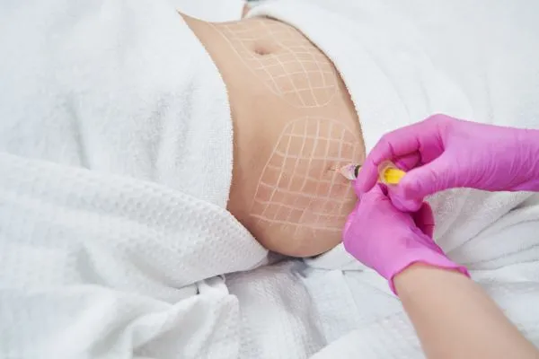 image of fat dissolving injections on love handles to help combat weight gain Blandford Forum
