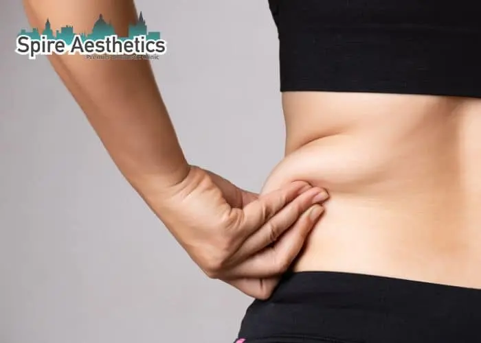 Image of woman pinching fat on their hips Blandford Forum. Fat Freezing treatment