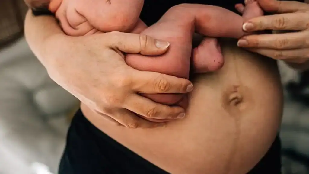 Why Is My Stomach Still Big After Pregnancy Blandford Forum?